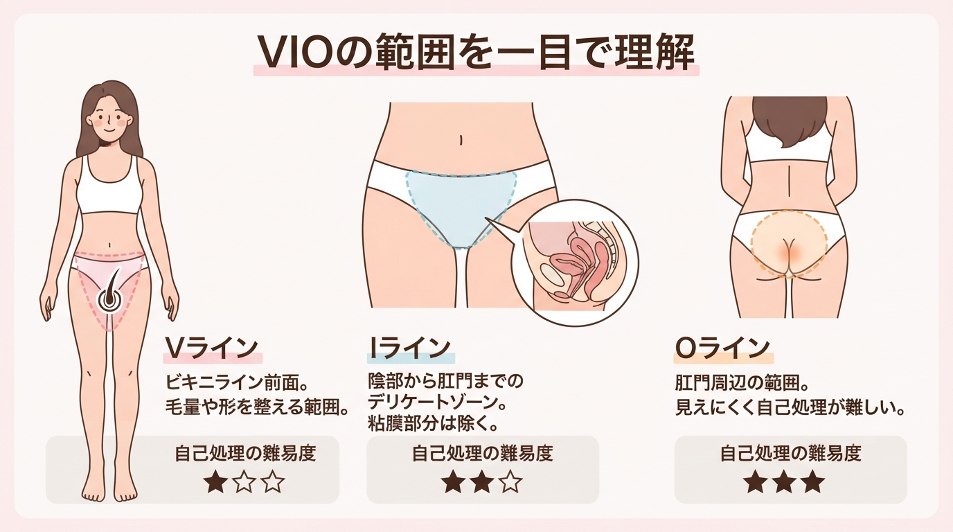 vioとは？範囲やメリット・おすすめの形を看護師が徹底解説のインフォグラフィック1