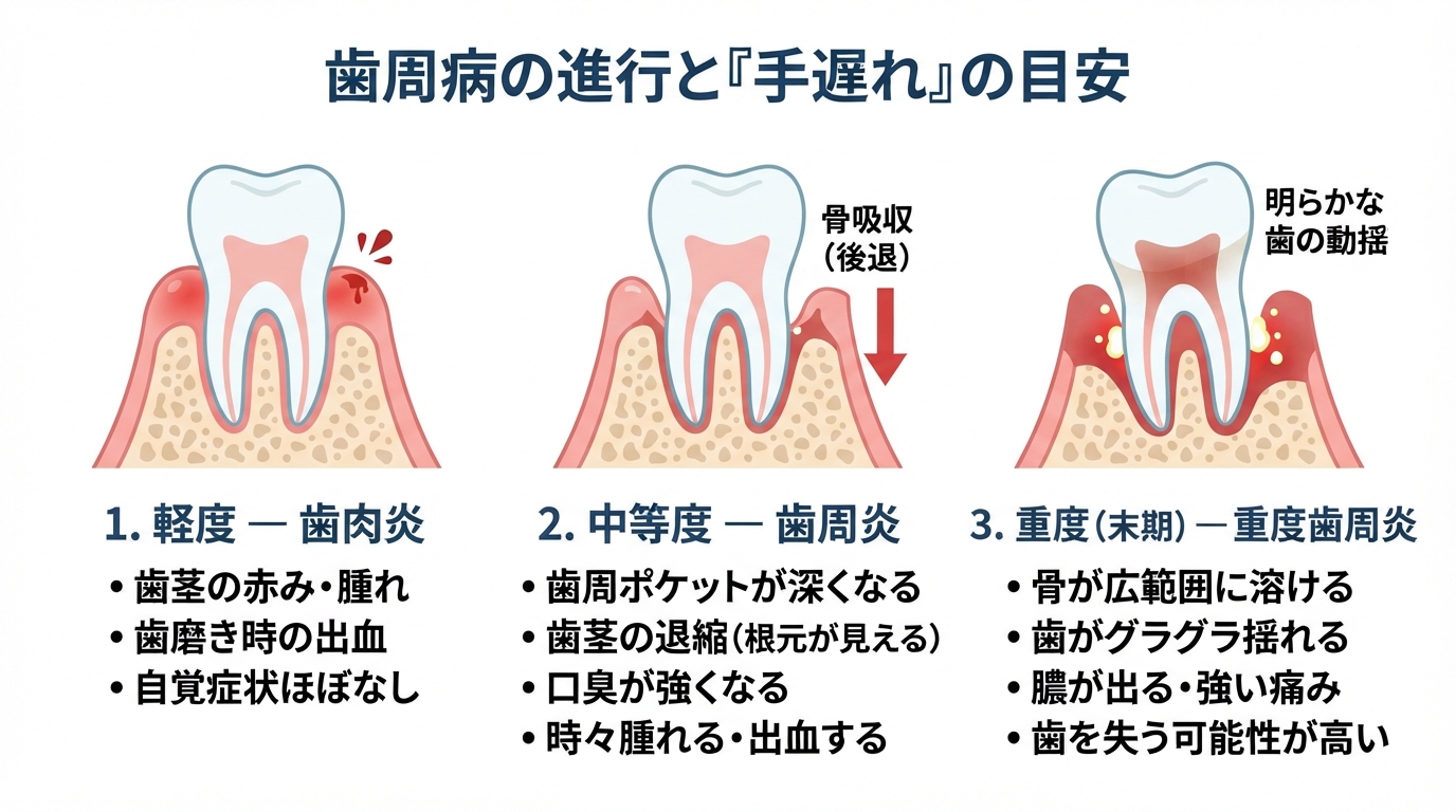 歯周病 手遅れ 症状|歯周病が手遅れと感じたら?症状と歯を残す治のインフォグラフィック1